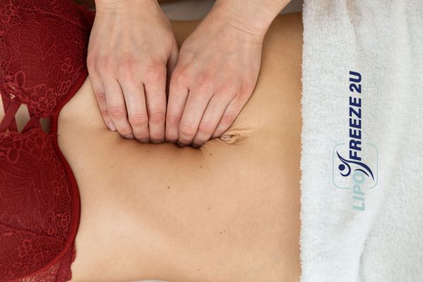 diastasis recti treatment Avon