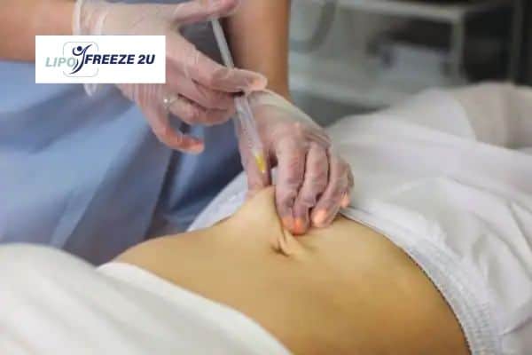 Fat Dissolving Injections Avon & Weight loss medication