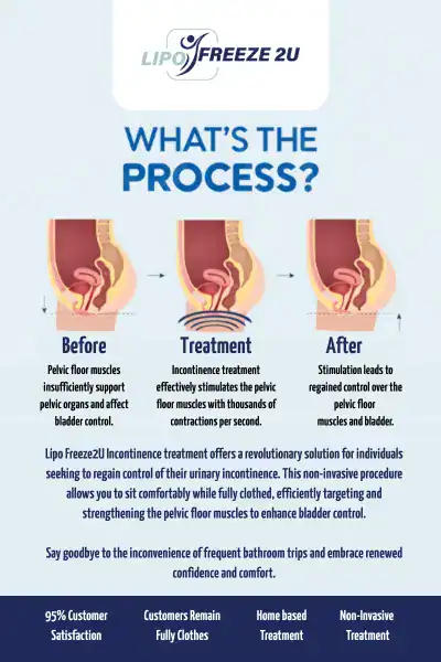 Diagram of how incontinence treatment Avon works.