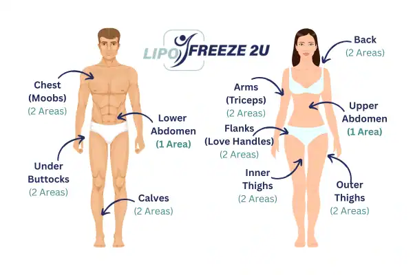 Areas you can have fat freezing treatment Avon