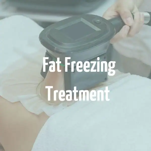 fat freezing treatment Avon
