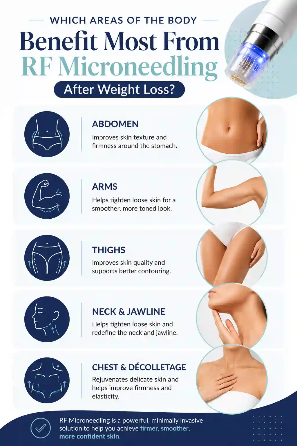 Which Areas of the Body Benefit Most From RF Microneedling After Weight Loss Avon